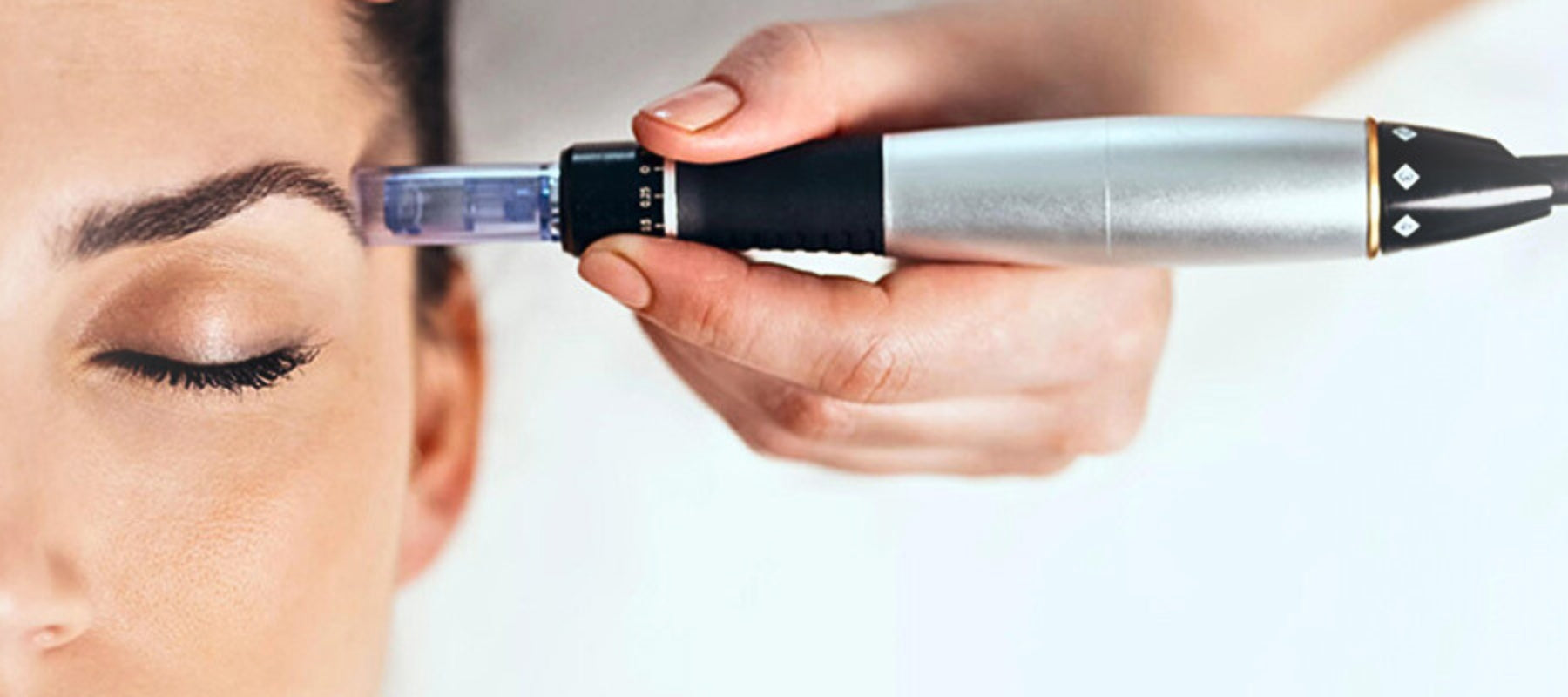 ¿Qué son el microneedling y los exosomas?