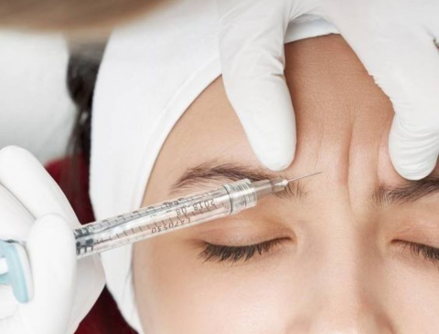 Botox y fillers: ¿cuáles son sus diferencias?