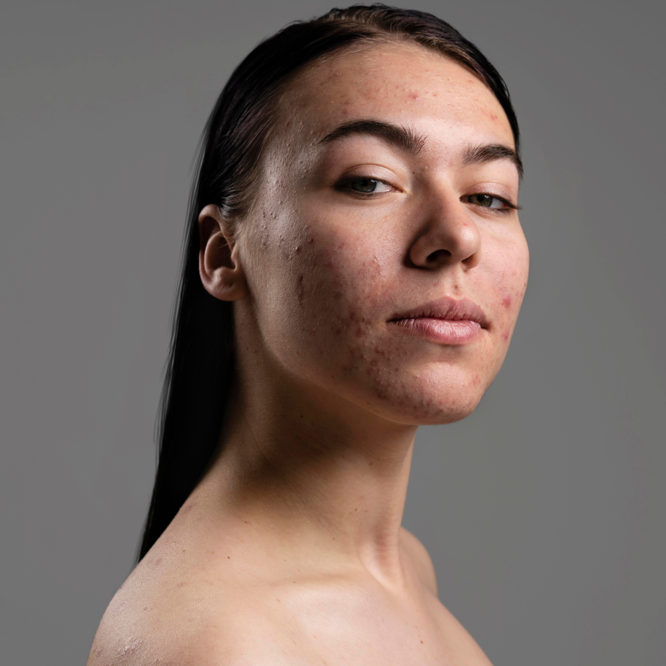 Spectra de Ojeras