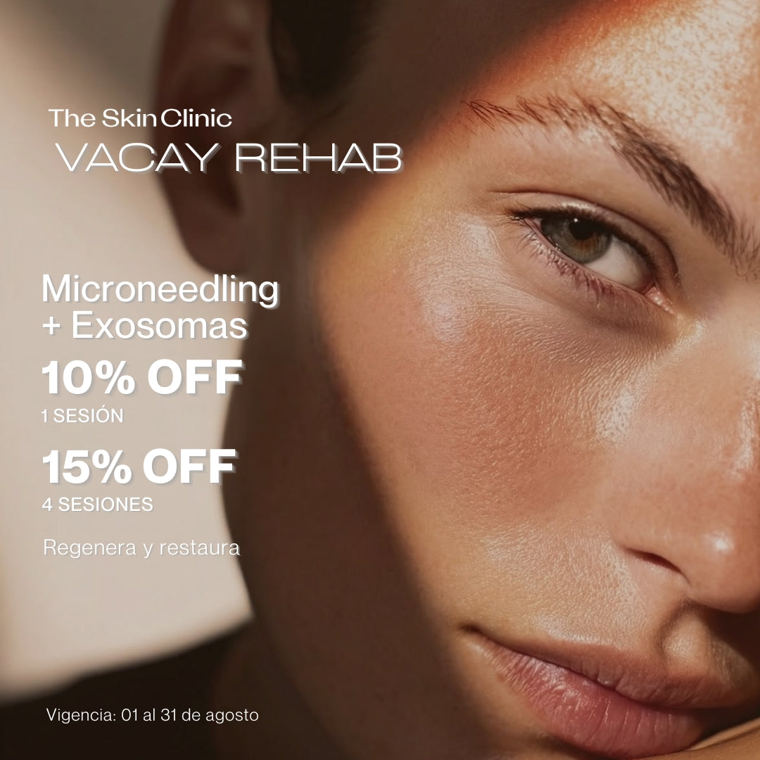 Microneedling +NCTF 10% 1 SESIÓN