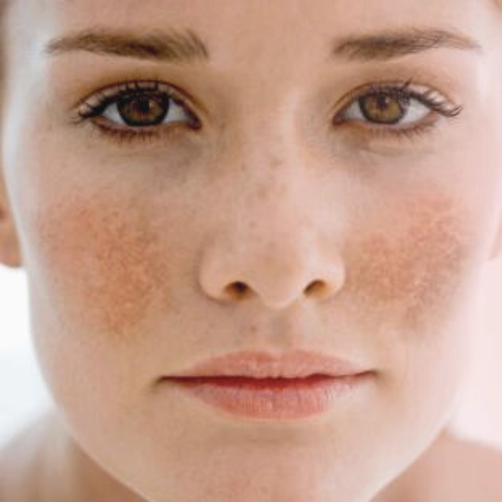 Depilación cara completa