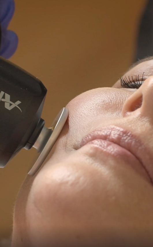  Prime X cara Tratamiento