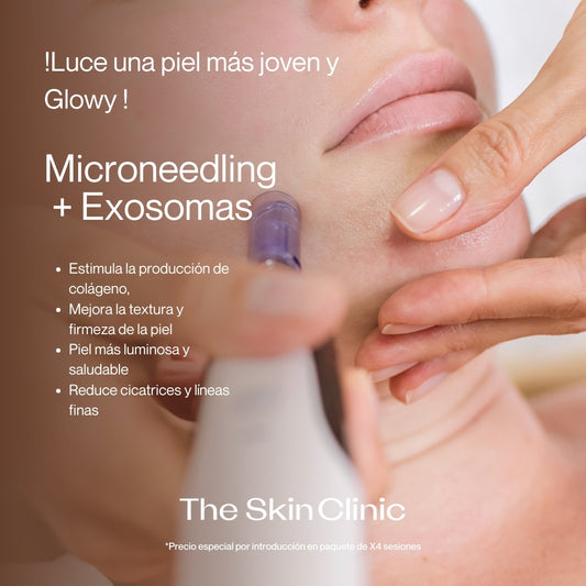 Microneedling+ Exosomas