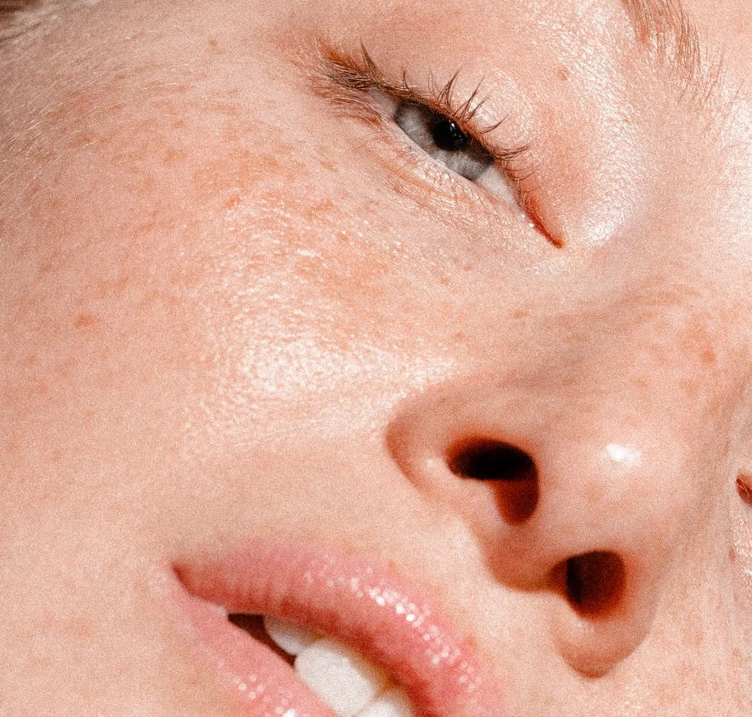 Te ayudamos a entender tu piel