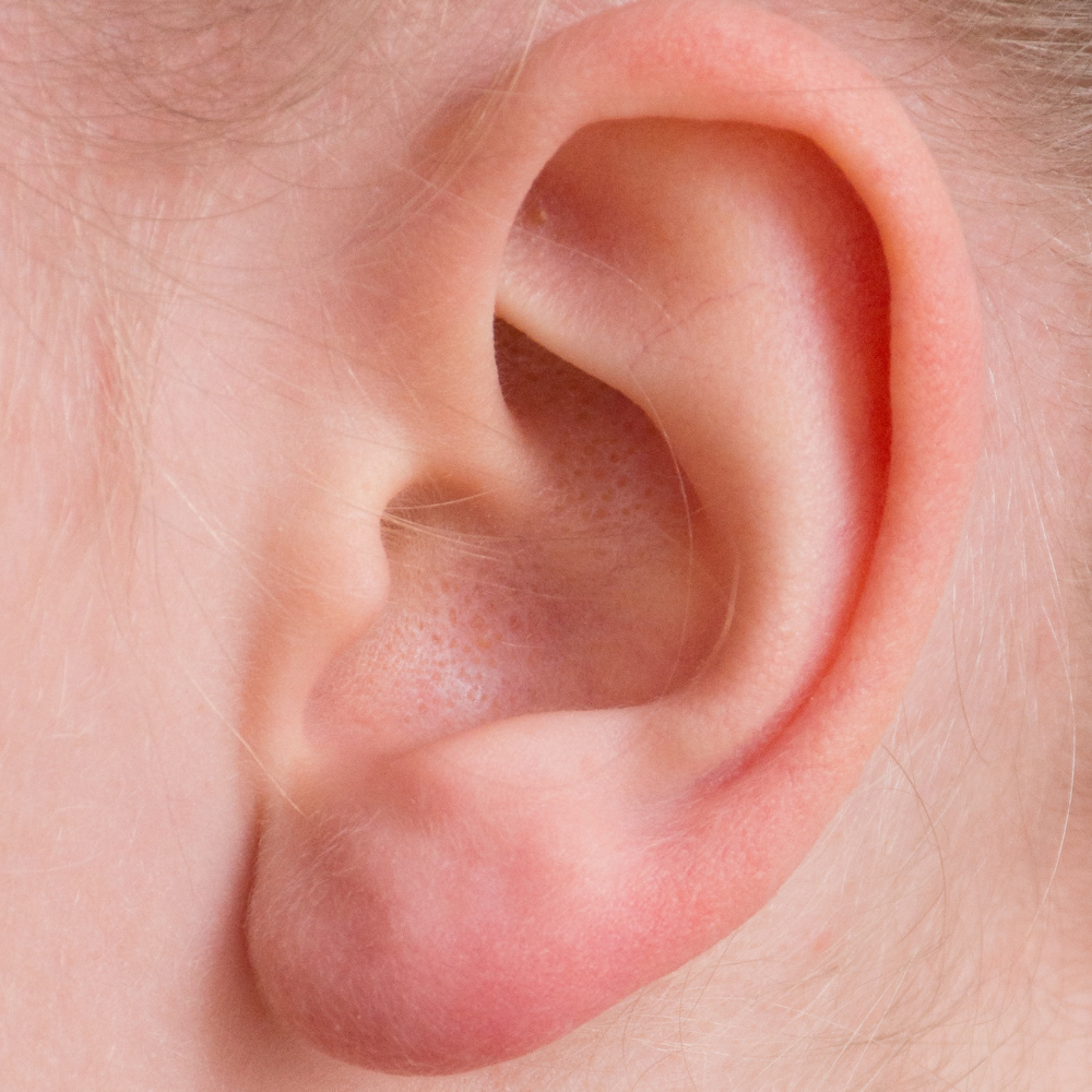 Depilación orejas